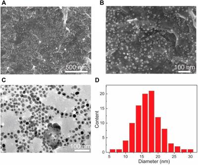 A Multicomponent Polymer-Metal-Enzyme System as Electrochemical Biosensor for H2O2 Detection